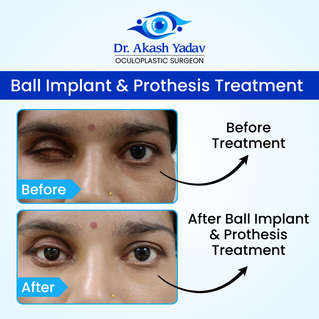 Akash Yadav - Before After Images (3)