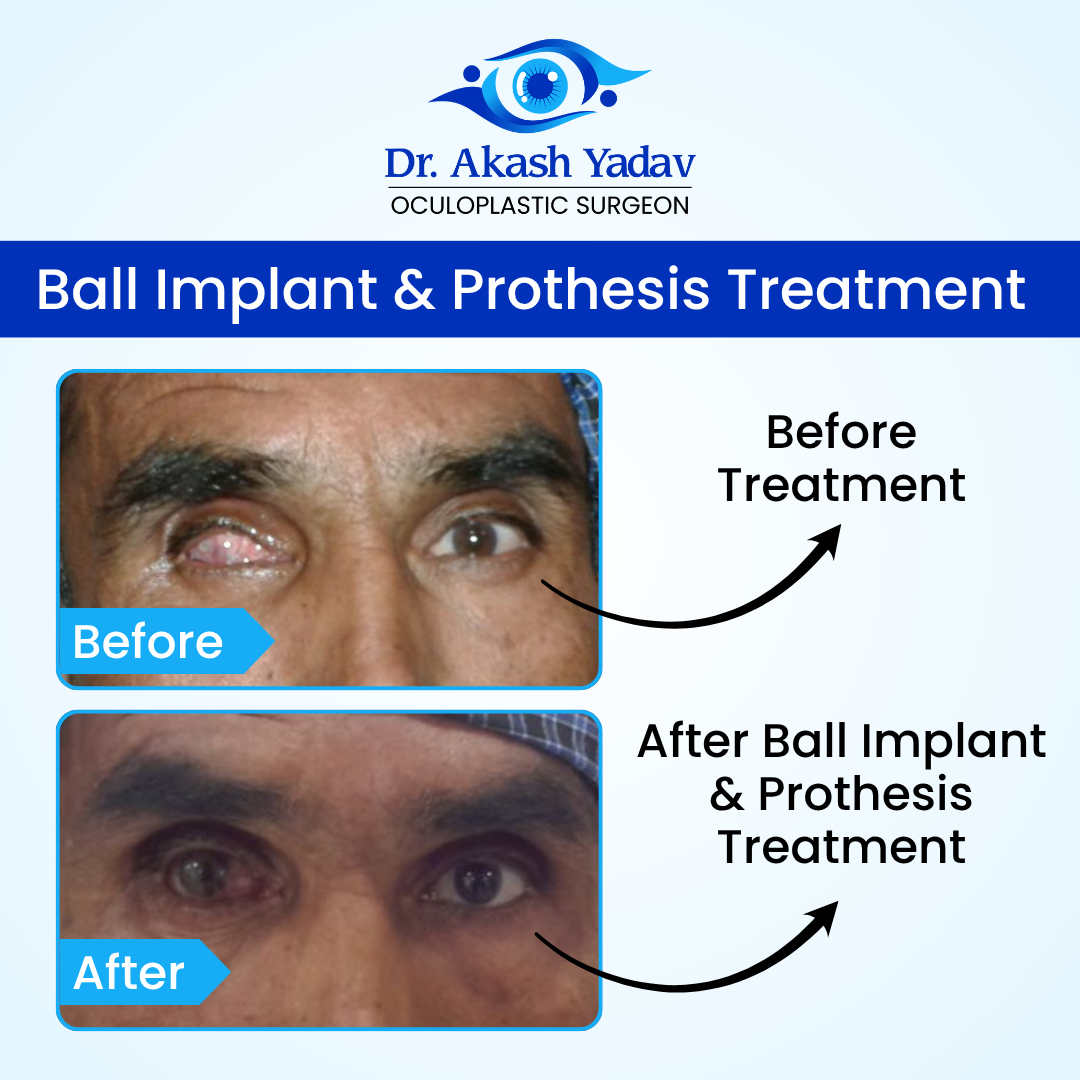 Akash Yadav - Before After Images (4)