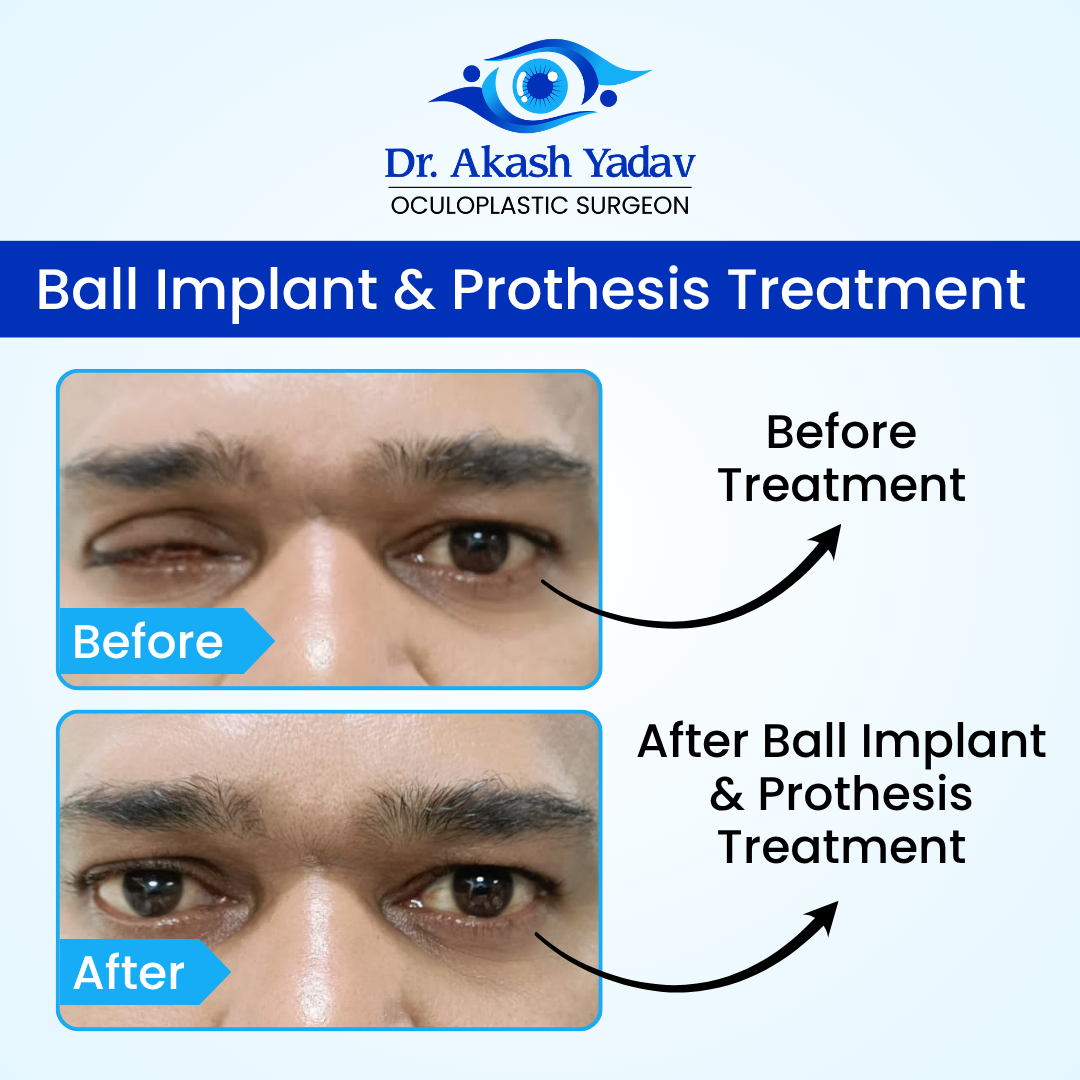 Akash Yadav - Before After Images (5)