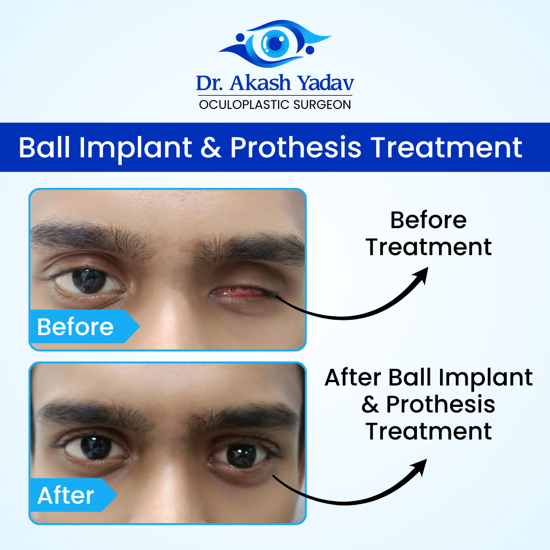 Akash Yadav - Before After Images (6)