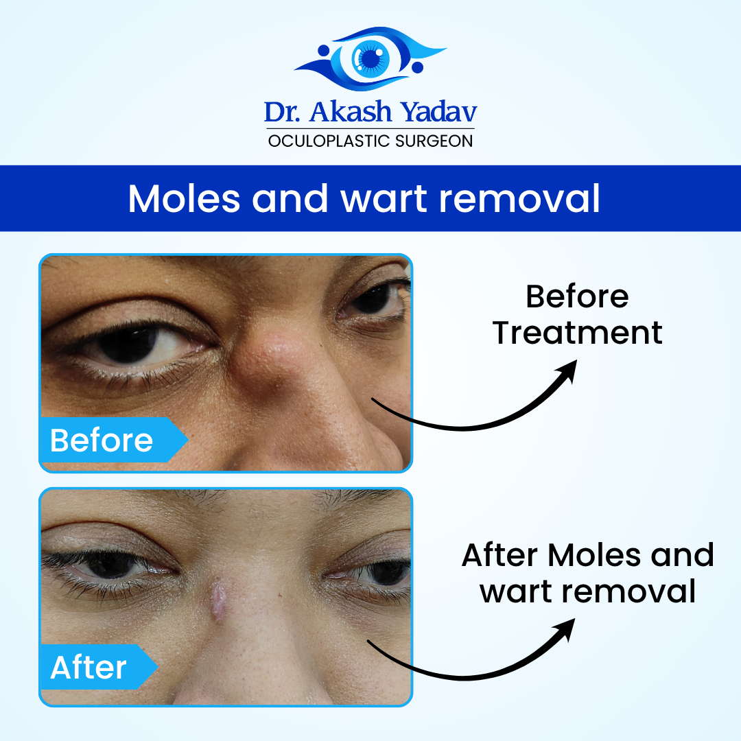 Akash Yadav - Before After Images (16)