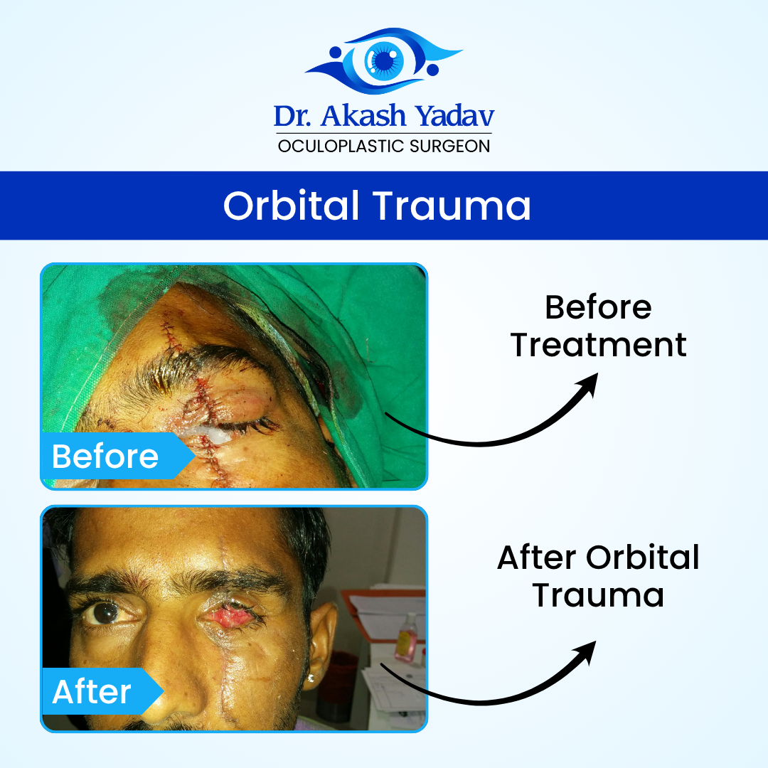 Akash Yadav - Before After Images (24)