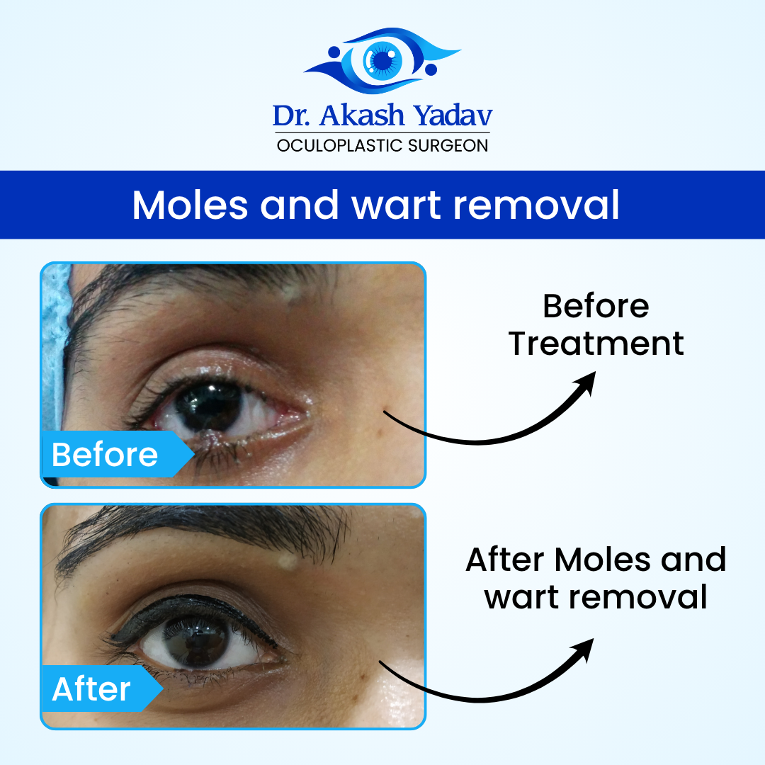 Akash Yadav - Before After Images (8)
