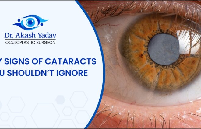 Early signs of cataract