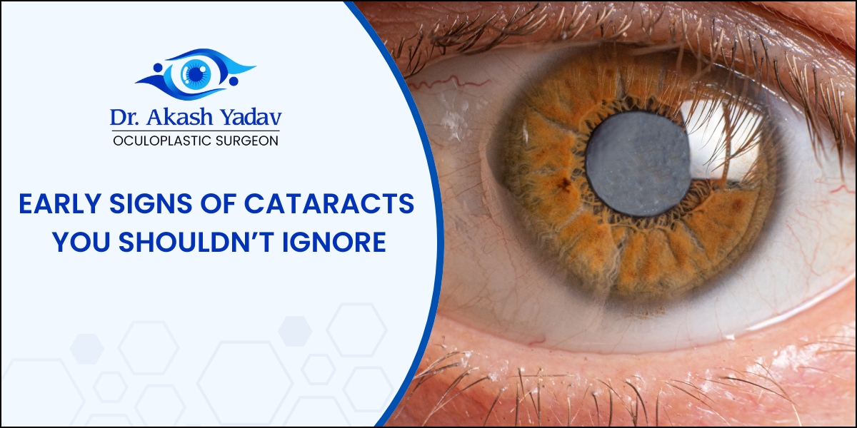 Early signs of cataract