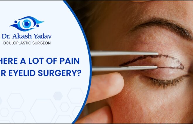 Eyelid Surgery Pain