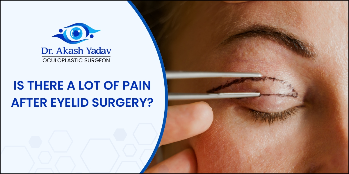 Eyelid Surgery Pain