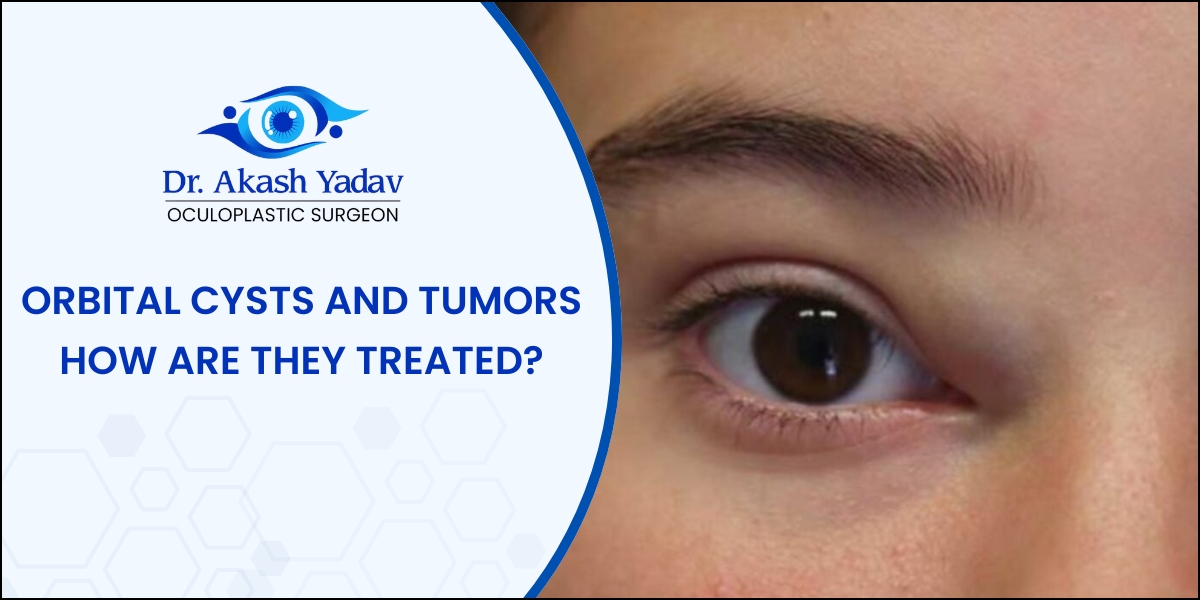 orbital cysts and tumors removal