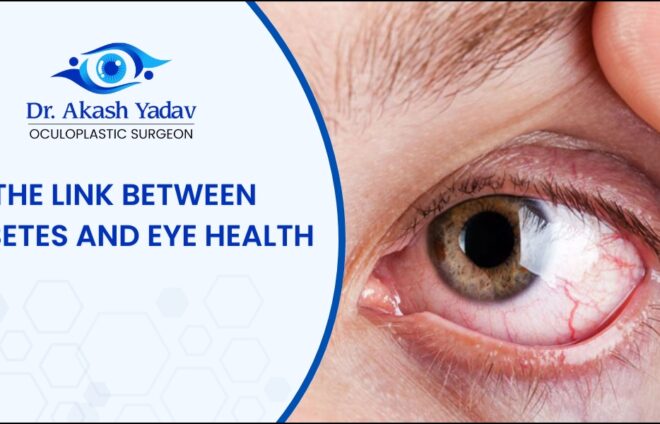 Diabetes and Eye Health