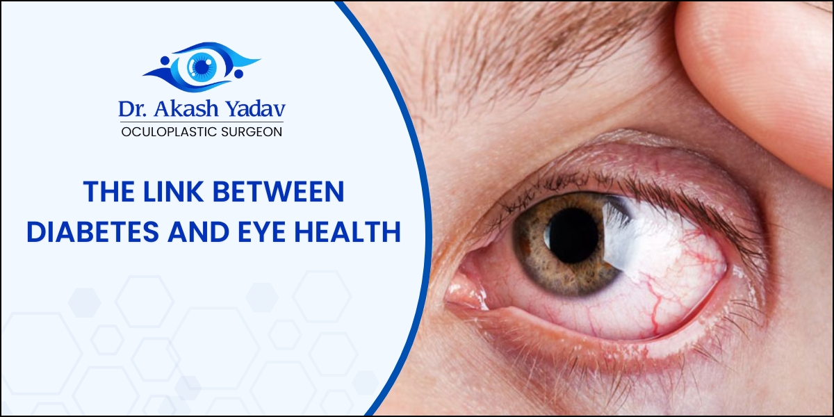 Diabetes and Eye Health