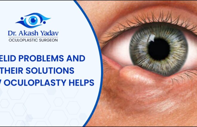 Eyelid Problems
