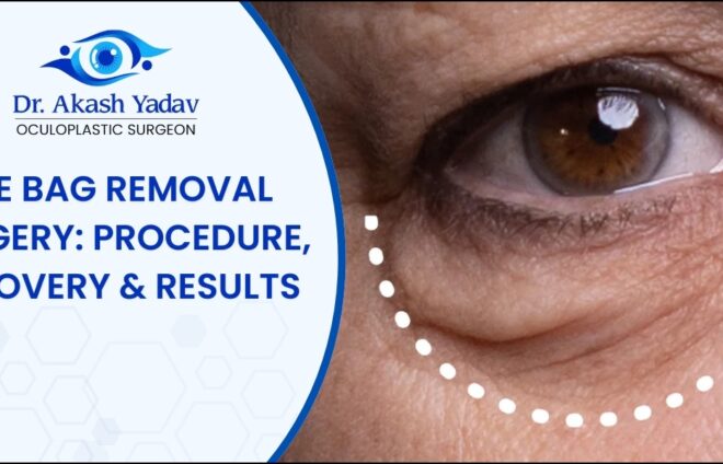 Eye Bag Removal Surgery
