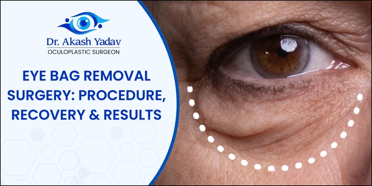 Eye Bag Removal Surgery