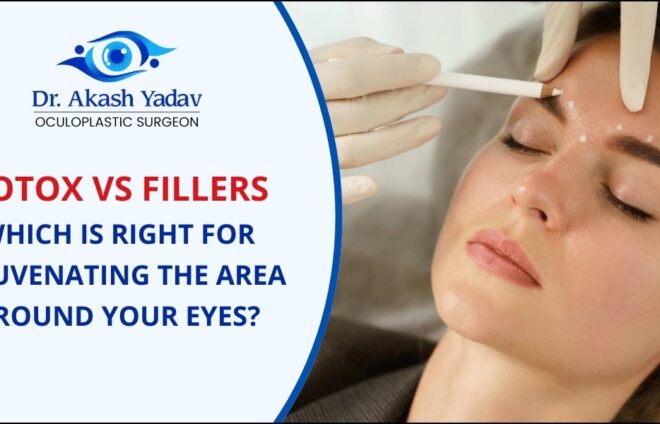 Botox vs. Fillers: Which is Right