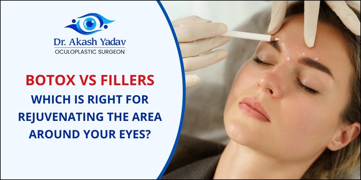 Botox vs. Fillers: Which is Right