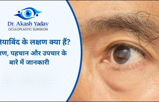 मोतियाबिंद के लक्षण