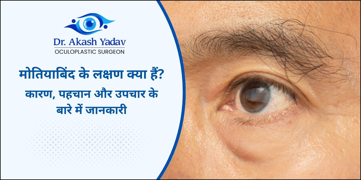 मोतियाबिंद के लक्षण