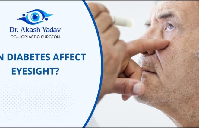 Connection between diabetes and eye health