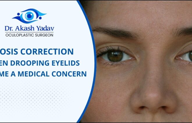 Ptosis Correction