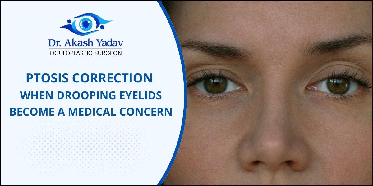 Ptosis Correction