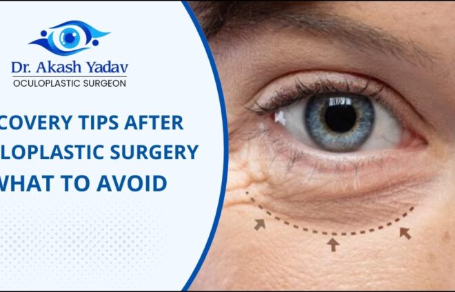 Oculoplastic surgery recovery tips
