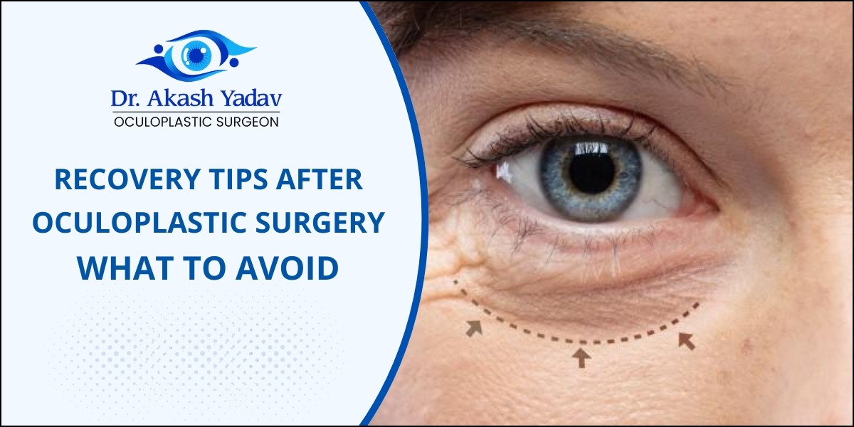 Oculoplastic surgery recovery tips