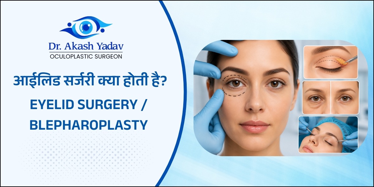 आईलिड सर्जरी क्या होती है?