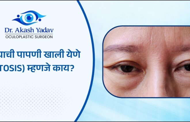 Ptosis म्हणजे काय?