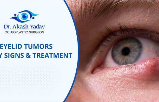 Eyelid Tumors Eyelid tumors treatment in pune