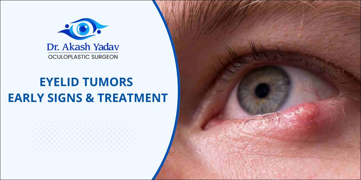 Eyelid tumors treatment in pune