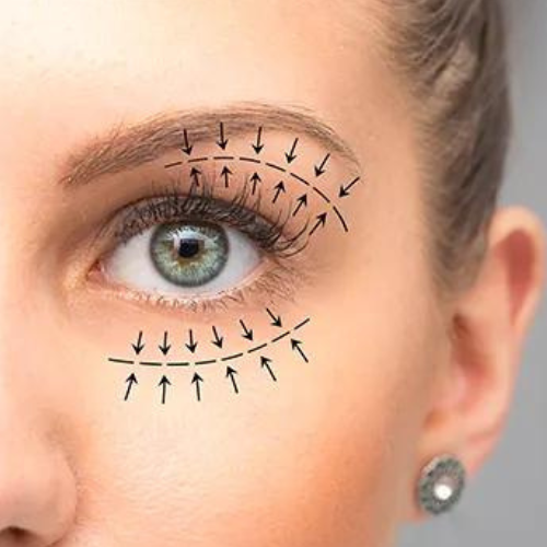 Oculoplasty Treatment Oculoplastic Surgery