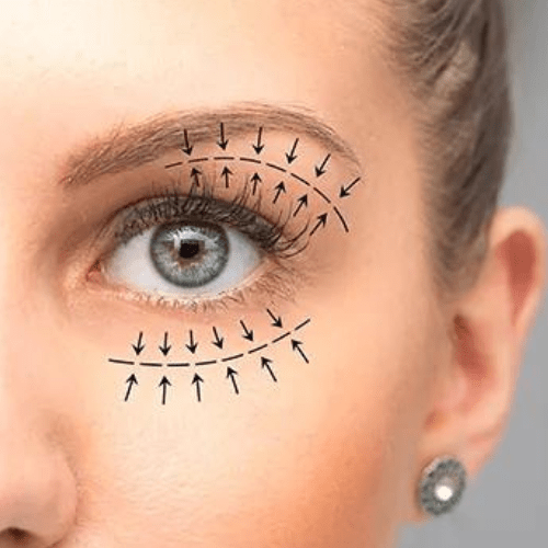 Oculoplastic Surgery